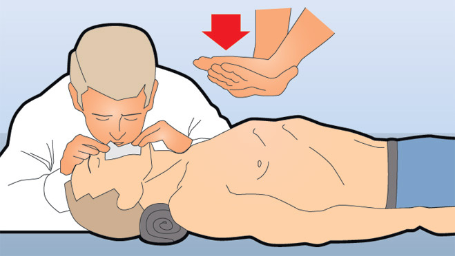 как делать массаж сердца человеку